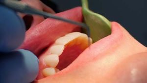 ΠΕΡΙΟΔΟΝΤΙΤΙΔΑ