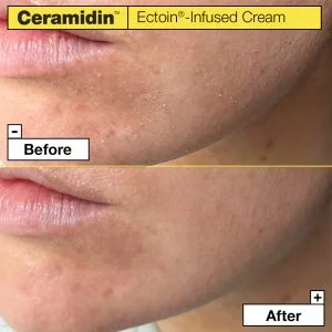 Ceramidin Ectoin Infused Cream 50ml Dr.Jart